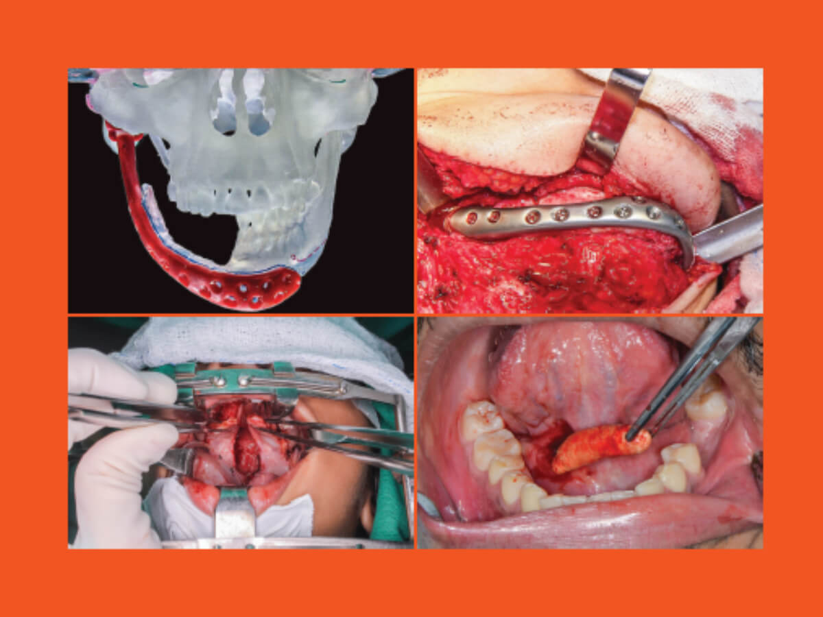 destaque jbcoms v07n2