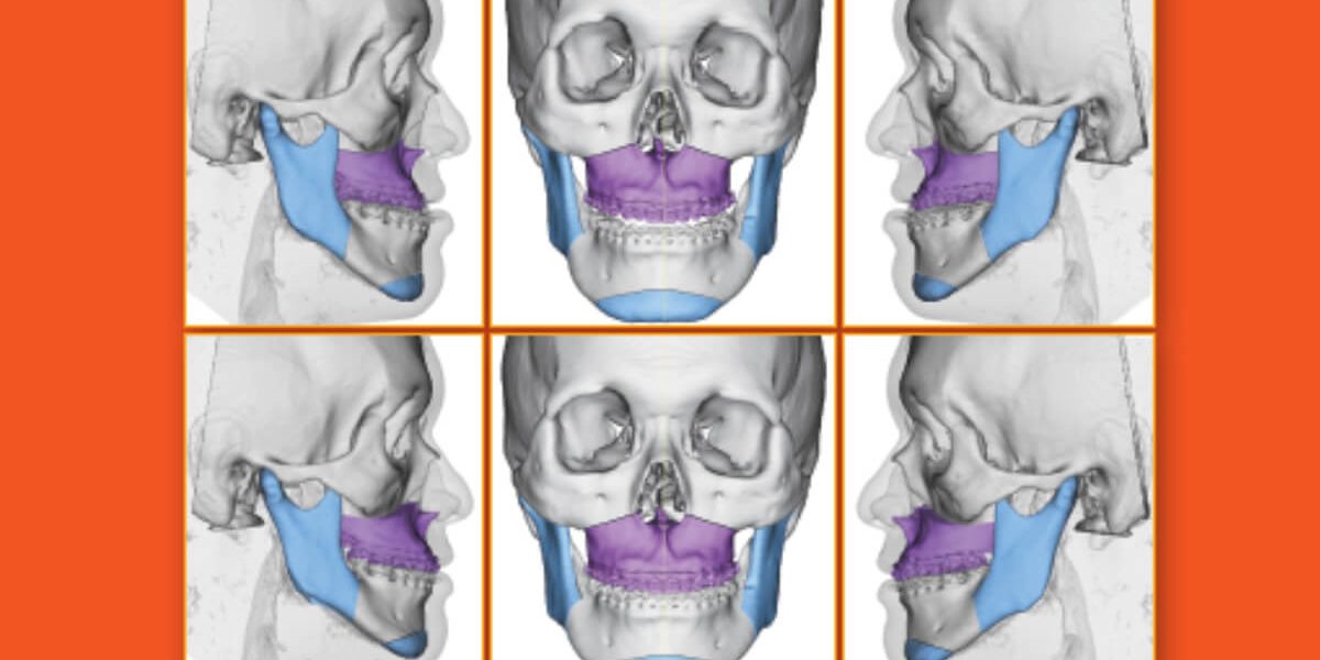 destaque-jbcoms-v05n2