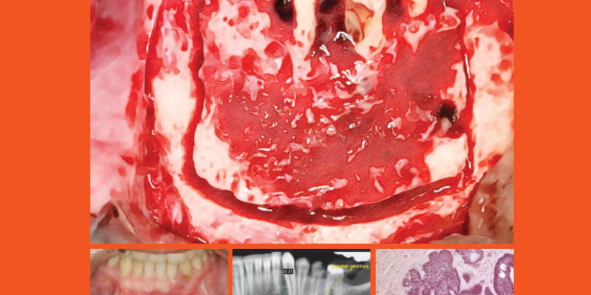 destaque-jbcoms-v05n3