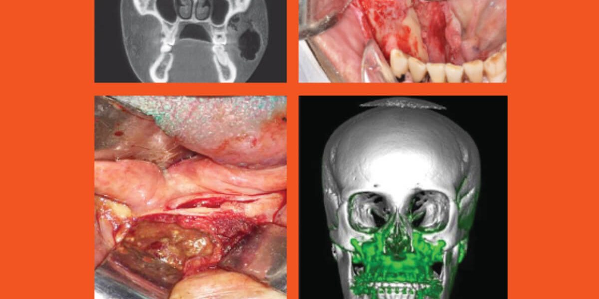 destaque-jbcoms-v06n1