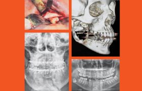 destaque-jbcoms-v06n2